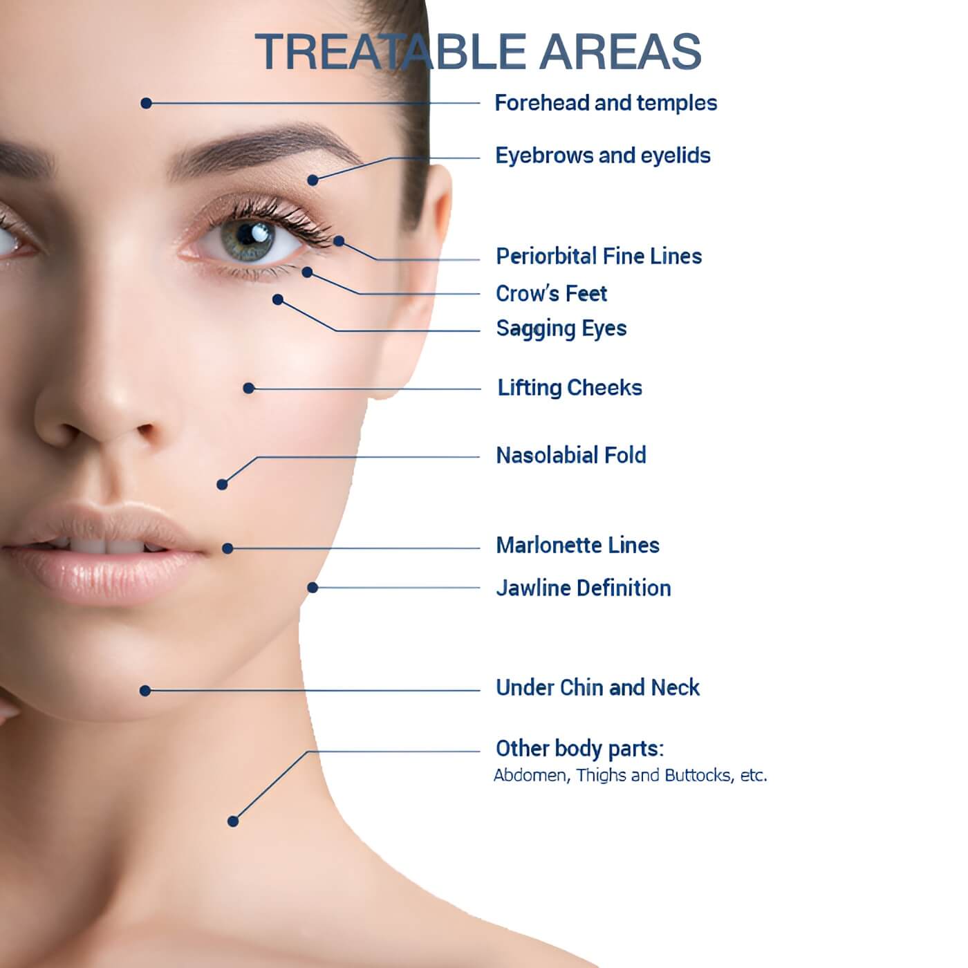 treatable areas RF face lifting salon Toujours Belle